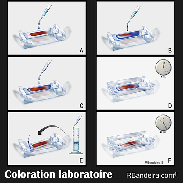 Coloration Laboratoire